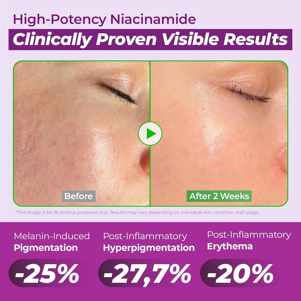 JUMISO 20% Niacinamide Dark Spot Correcting Serum for Face