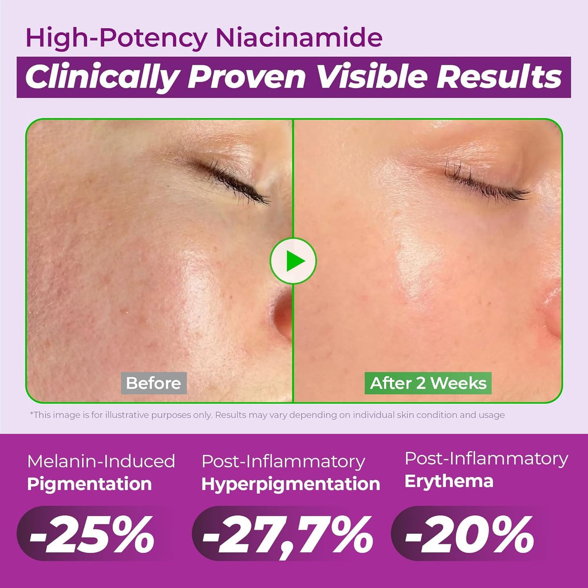 JUMISO 20% Niacinamide Dark Spot Correcting Serum for Face
